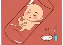 黄体功能不足怀孕后怎么保胎